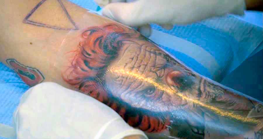 Заживление татуировки