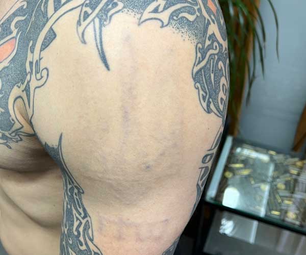 posle-del-tattoo-1501 posle-del-tattoo-1501