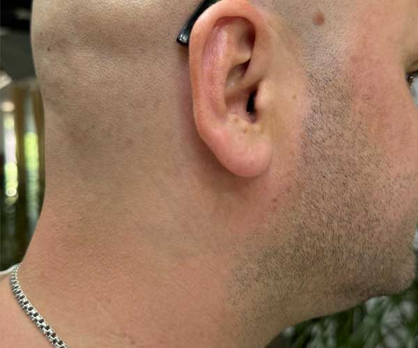 posle-del-tattoo-1504 posle-del-tattoo-1504