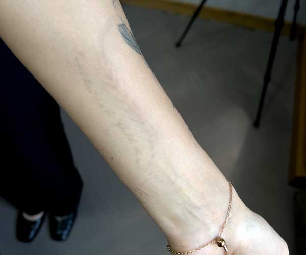 posle-del-tattoo-1504 posle-del-tattoo-1504