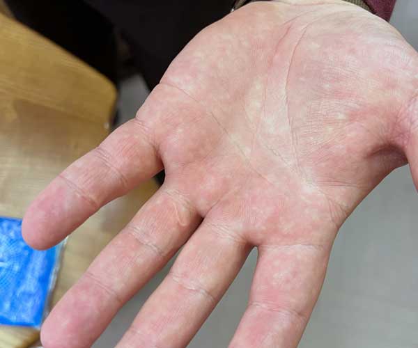 posle-del-tattoo-1601 posle-del-tattoo-1601